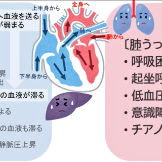 第98回 問110 過去問解説 | e-REC | 薬剤師国家試験予備校